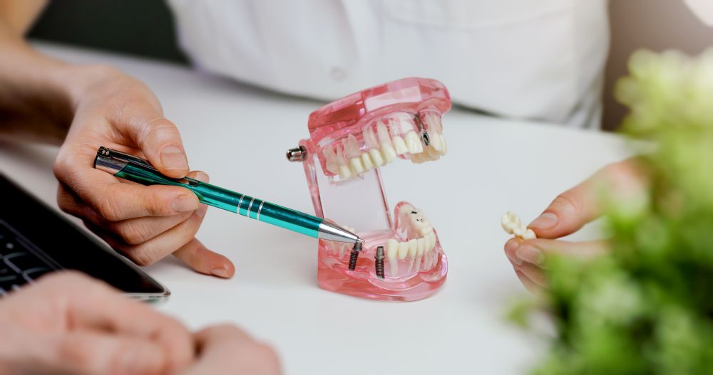 dental implant