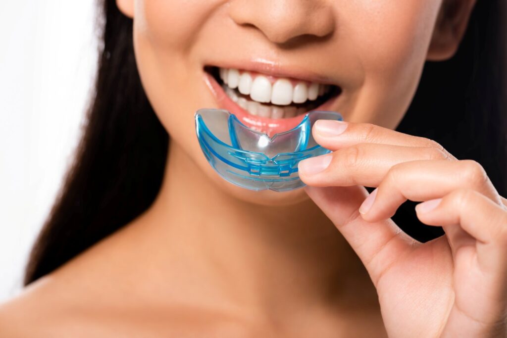 koelker dental mouth guard