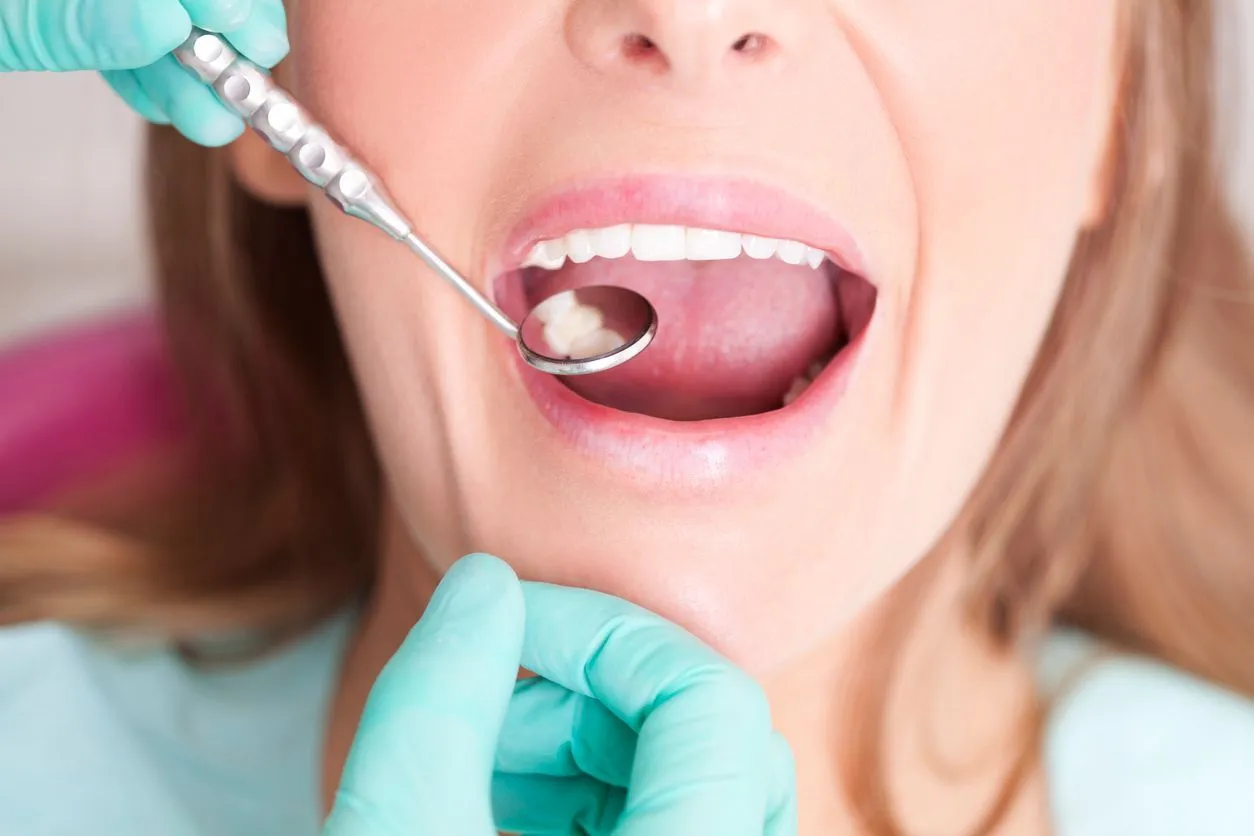 Close-up of dentist examining patient teeth during appointment