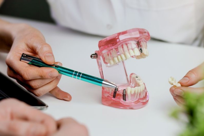 Dentist demonstrating dental procedure using model teeth